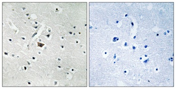 PC-PLD2 (phospho Tyr169) rabbit pAb