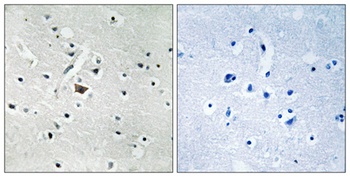 PC-PLD2 (phospho-Tyr169) antibody