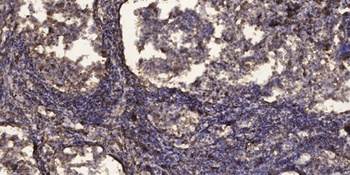 Plk1 (phospho Ser137) rabbit pAb
