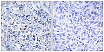 Plk (phospho Thr210) rabbit pAb