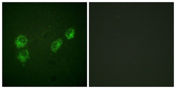 PLB (phospho Ser16/T17) rabbit pAb