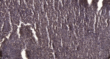 PLB (phospho Ser16/T17) rabbit pAb