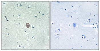 EDG-8 antibody