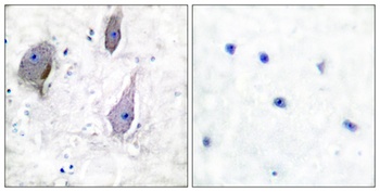 GAS3 antibody