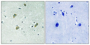 Casein Kinase Iγ1/2/3 rabbit pAb
