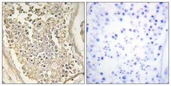ATP7B rabbit pAb