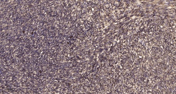 Septin 5 antibody