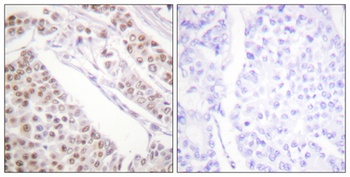 Acetyl Histone H2B (K12) rabbit pAb
