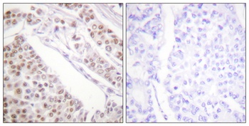 Acetyl Histone H2B (K12) antibody