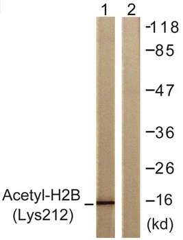 Acetyl Histone H2B (K12) antibody
