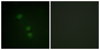 Histone H2B (Acetyl Lys15) rabbit pAb