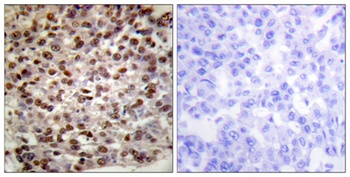 Histone H2B (Acetyl Lys15) rabbit pAb