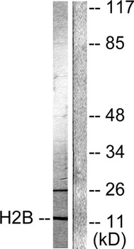Histone H2B (Acetyl Lys15) rabbit pAb