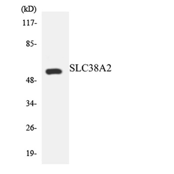 SNAT2 antibody