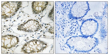 ATR (phospho Ser428) rabbit pAb