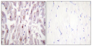 TRAP220 (phospho Thr1457) rabbit pAb