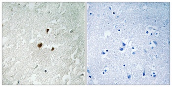 Rrn3 (phospho Ser649) rabbit pAb