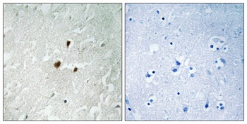 Rrn3 (phospho-Ser649) antibody