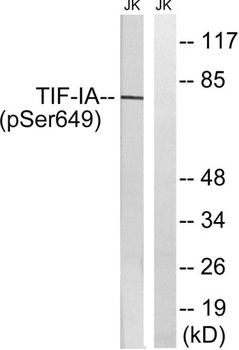 Rrn3 (phospho Ser649) rabbit pAb