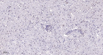 Rrn3 antibody