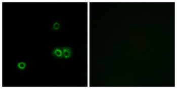 MARCH5 antibody