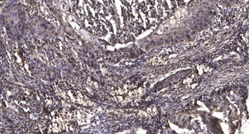 mPR gamma antibody