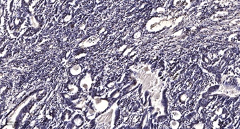 LPCAT2 rabbit pAb