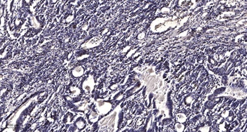 LPCAT2 antibody