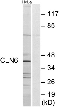 CLN6 antibody