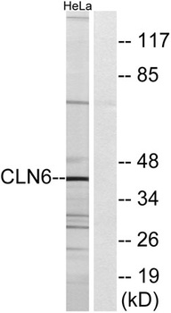 CLN6 rabbit pAb