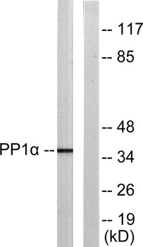 PP1α (phospho Thr320) rabbit pAb