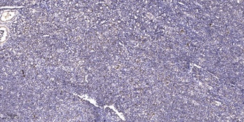 PRPF39 rabbit pAb