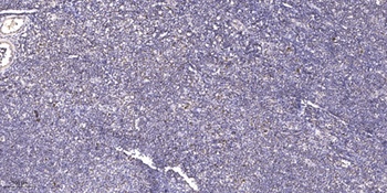 PRPF39 antibody