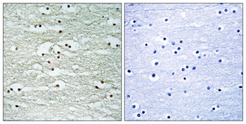 Nop132 rabbit pAb