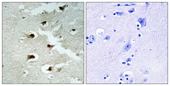 CdcA4 rabbit pAb