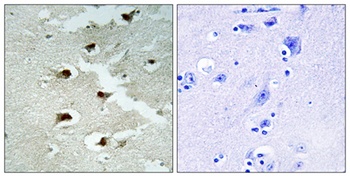 CdcA4 antibody