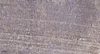 IPP-2 (phospho Ser44) rabbit pAb