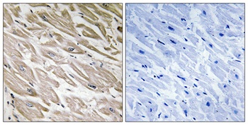 IPP-2 (phospho Ser120/S121) rabbit pAb