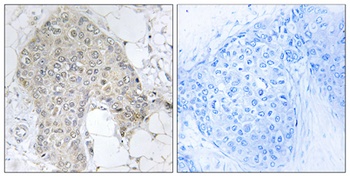 IPP-2 antibody