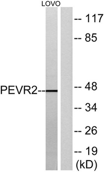 GPR172B antibody