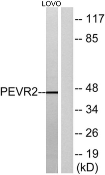 GPR172B rabbit pAb