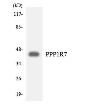 Sds22 rabbit pAb