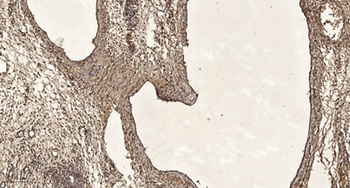 Sds22 rabbit pAb