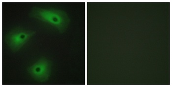TMEM16A rabbit pAb Antibody