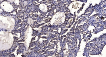 SLC6A15 antibody