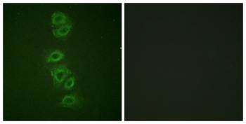 PP2A-Cα (phospho Tyr307) rabbit pAb