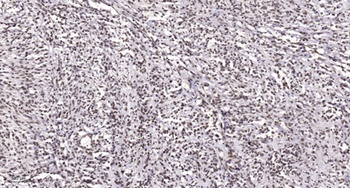 RFWD3 antibody