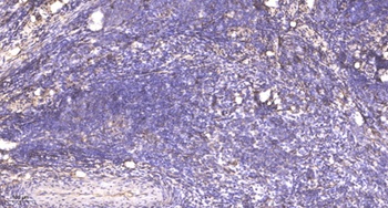 PP2A-B55-β rabbit pAb Antibody