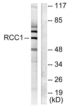 CLLD7 antibody