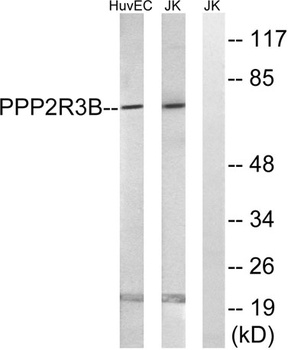 PP2A-B56-δ rabbit pAb